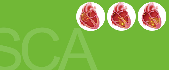 Sudden Cardiac Arrest Is Not the Same as a Heart Attack Sudden Cardiac Arrest Is Not the Same as a Heart Attack