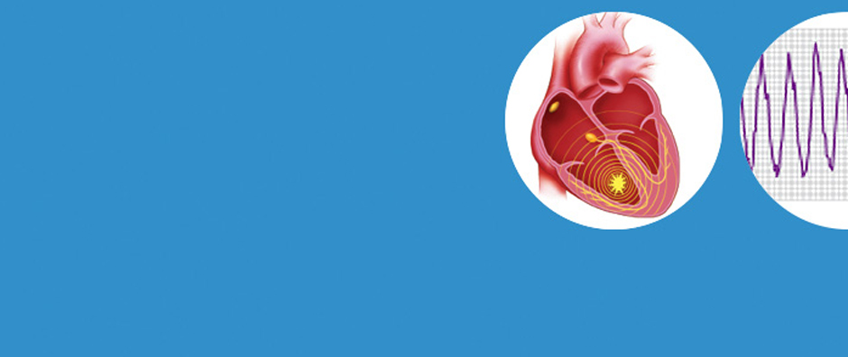 An S-ICD Works Even If You Feel No Symptoms An S-ICD Works Even If You Feel No Symptoms